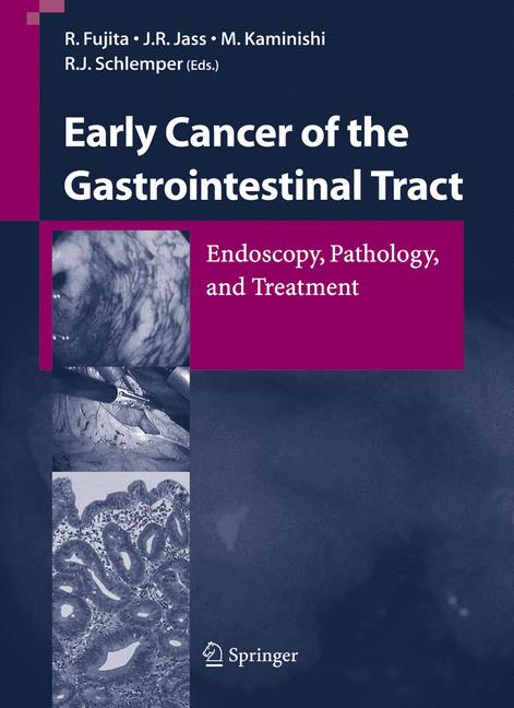 Weitere Ansicht: Early Cancer of the Gastrointestinal Tract