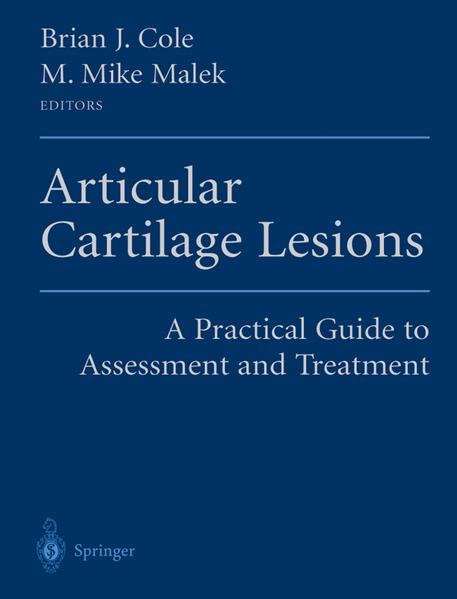 Produktbild: Articular Cartilage Lesions