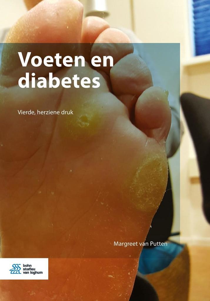 Produktbild: Voeten en diabetes | Margreet van Putten