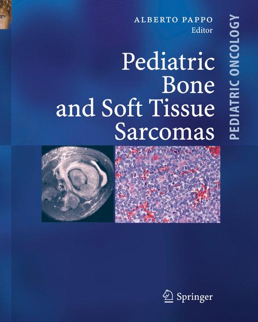 Weitere Ansicht: Pediatric Bone and Soft Tissue Sarcomas