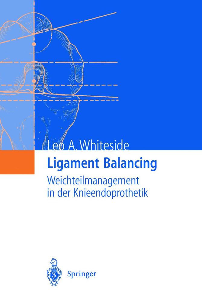 Produktbild: Ligament Balancing | Leo A. Whiteside