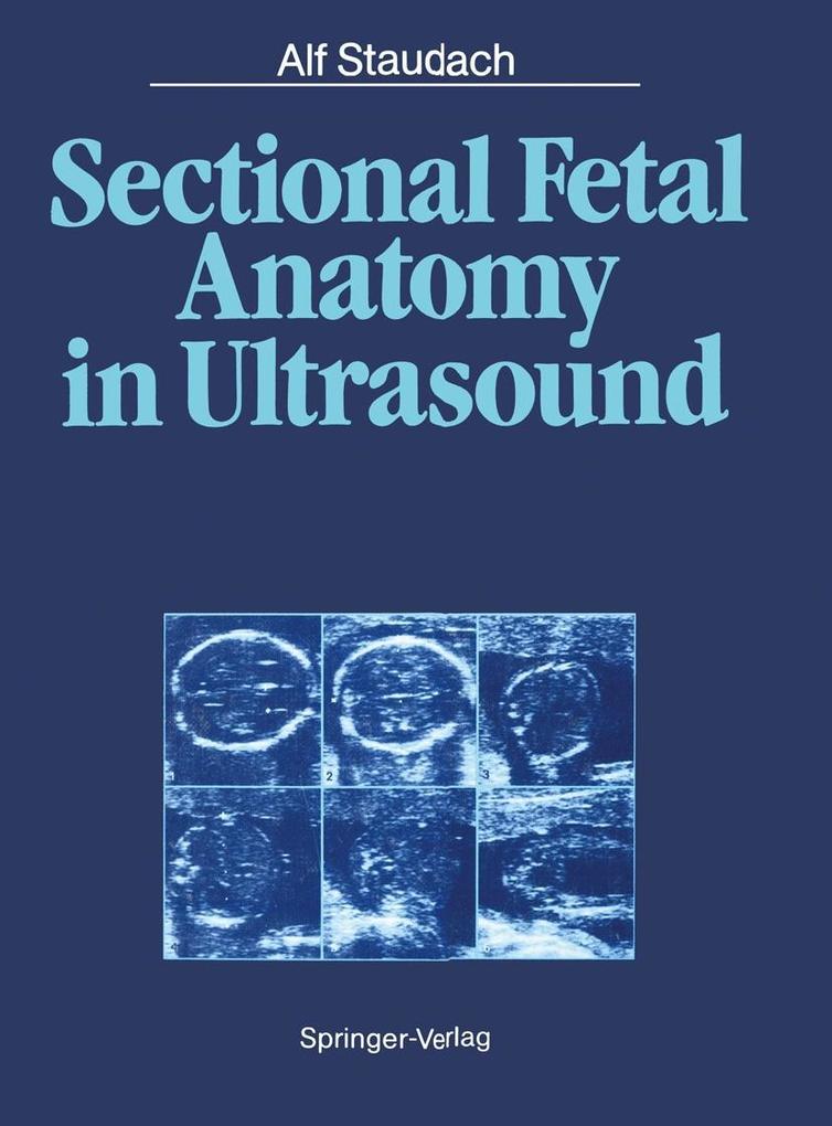 Produktbild: Sectional Fetal Anatomy in Ultrasound | Alf Staudach