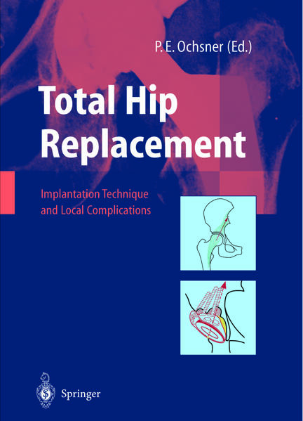 Produktbild: Total Hip Replacement