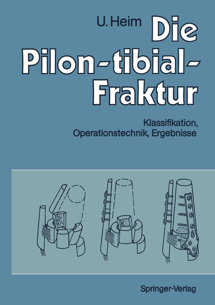 Produktbild: Die Pilon-tibial-Fraktur | Urs Heim