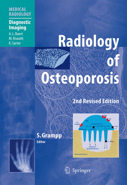 Produktbild: Radiology of Osteoporosis | A.L. Baert