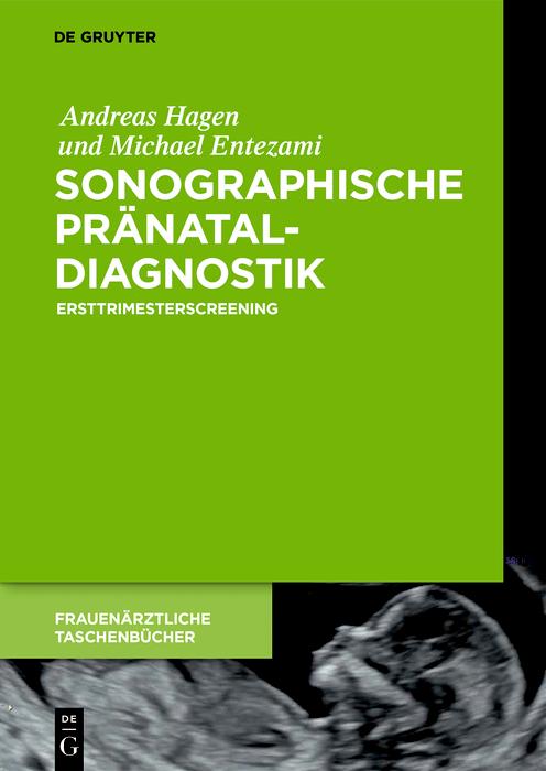 Produktbild: Sonographische Pränataldiagnostik | Andreas Hagen, Michael Entezami