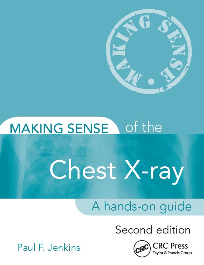 Making Sense of the Chest X-ray als eBook epub