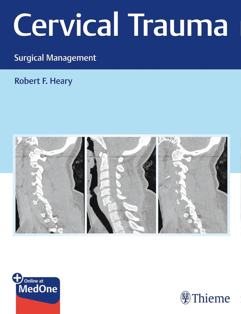Produktbild: Cervical Trauma | Robert Heary