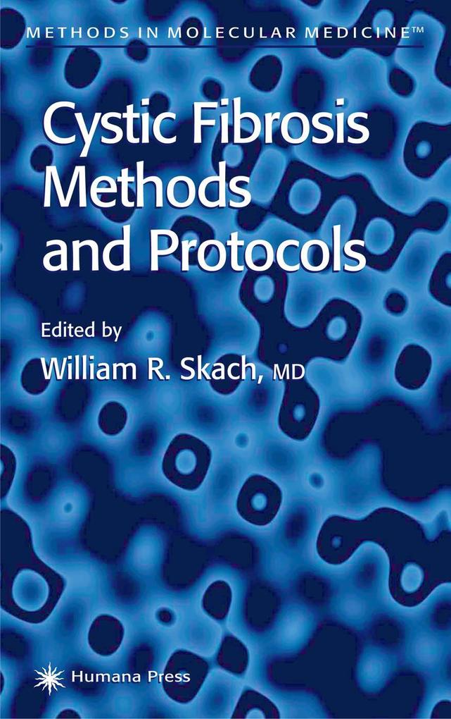 Cystic Fibrosis Methods and Protocols als Buch (gebunden)