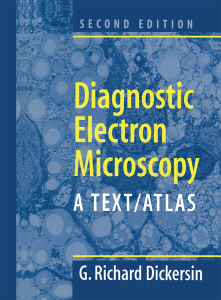 Diagnostic Electron Microscopy: A Text/Atlas als Buch (gebunden)