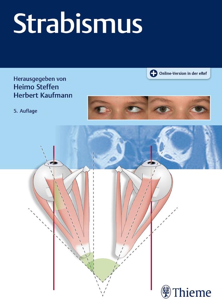 Produktbild: Strabismus