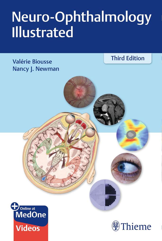 Produktbild: Neuro-Ophthalmology Illustrated | Valerie Biousse, Nancy Newman