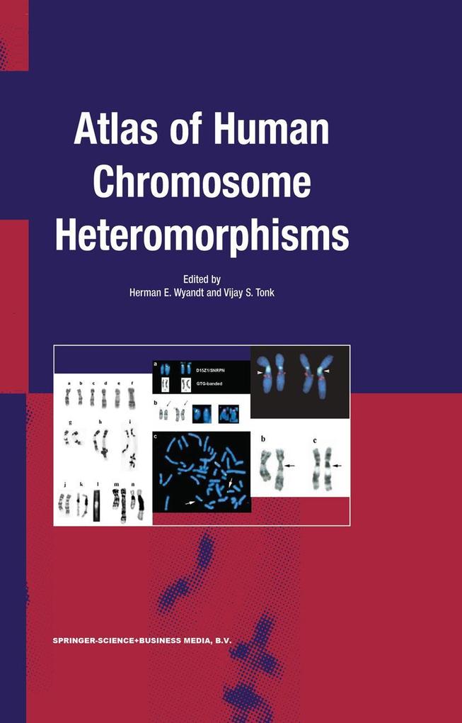Produktbild: Atlas of Human Chromosome Heteromorphisms