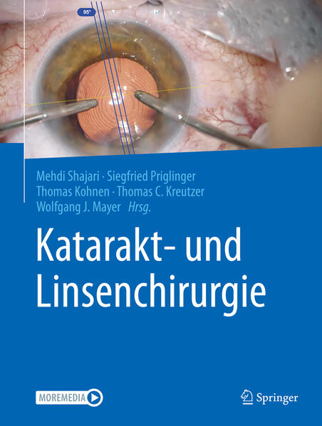 Produktbild: Katarakt- und Linsenchirurgie