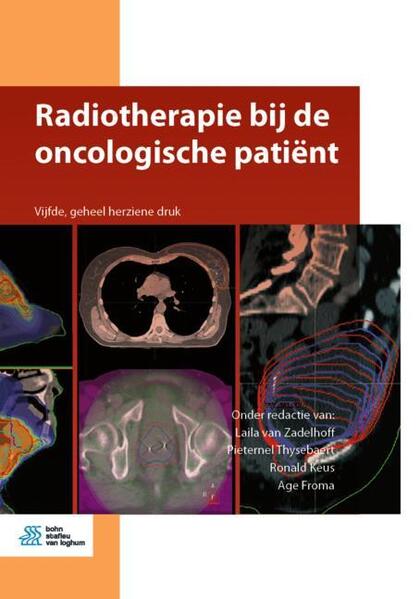 Produktbild: Radiotherapie bij de oncologische patiënt