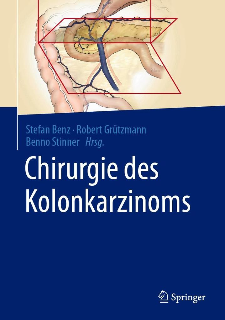 Produktbild: Chirurgie des Kolonkarzinoms