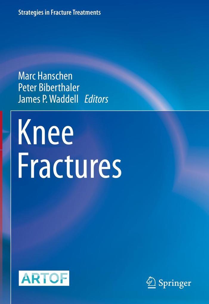 Produktbild: Knee Fractures