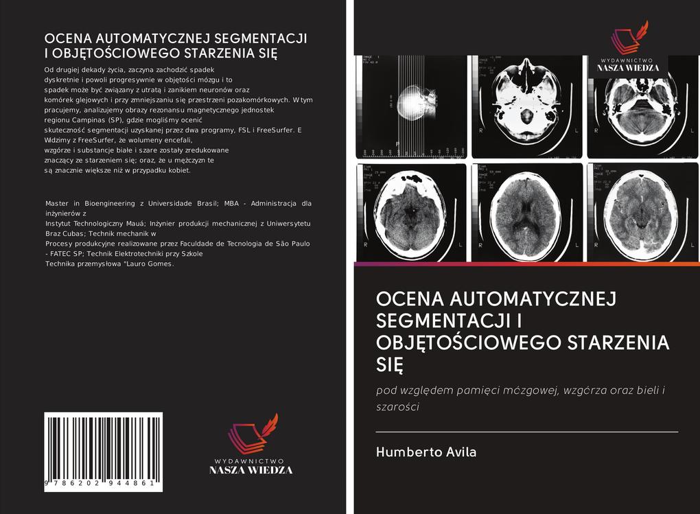 Produktbild: OCENA AUTOMATYCZNEJ SEGMENTACJI I OBJTOCIOWEGO STARZENIA SI | Humberto Avila