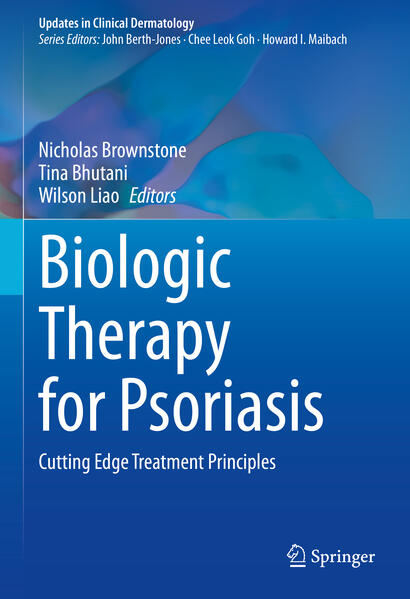 Produktbild: Biologic Therapy for Psoriasis