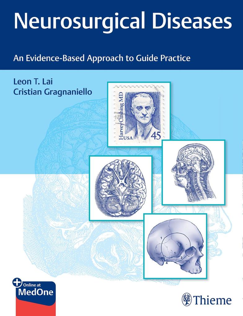Produktbild: Neurosurgical Diseases