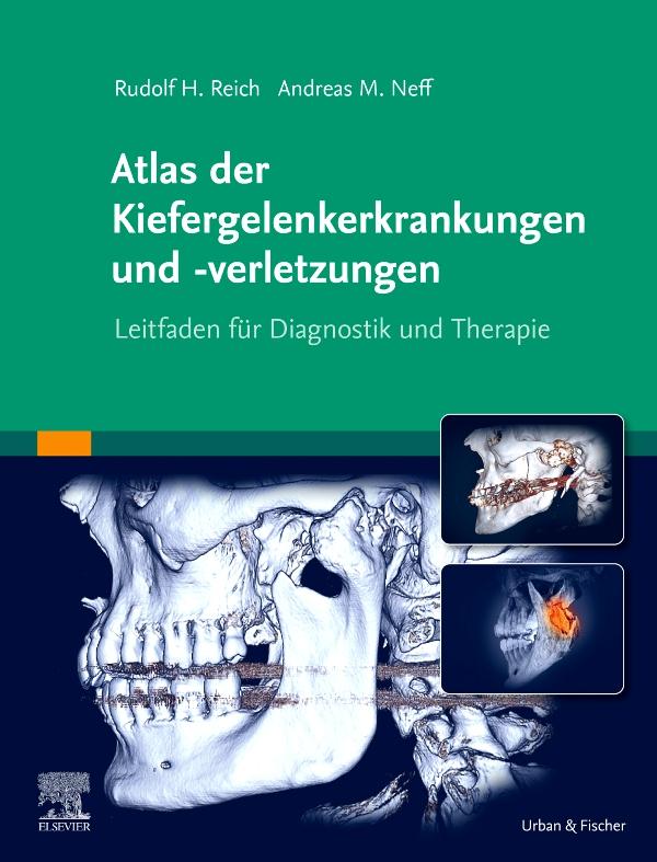Produktbild: Atlas der Kiefergelenkerkrankungen und -verletzungen | Andreas Neff