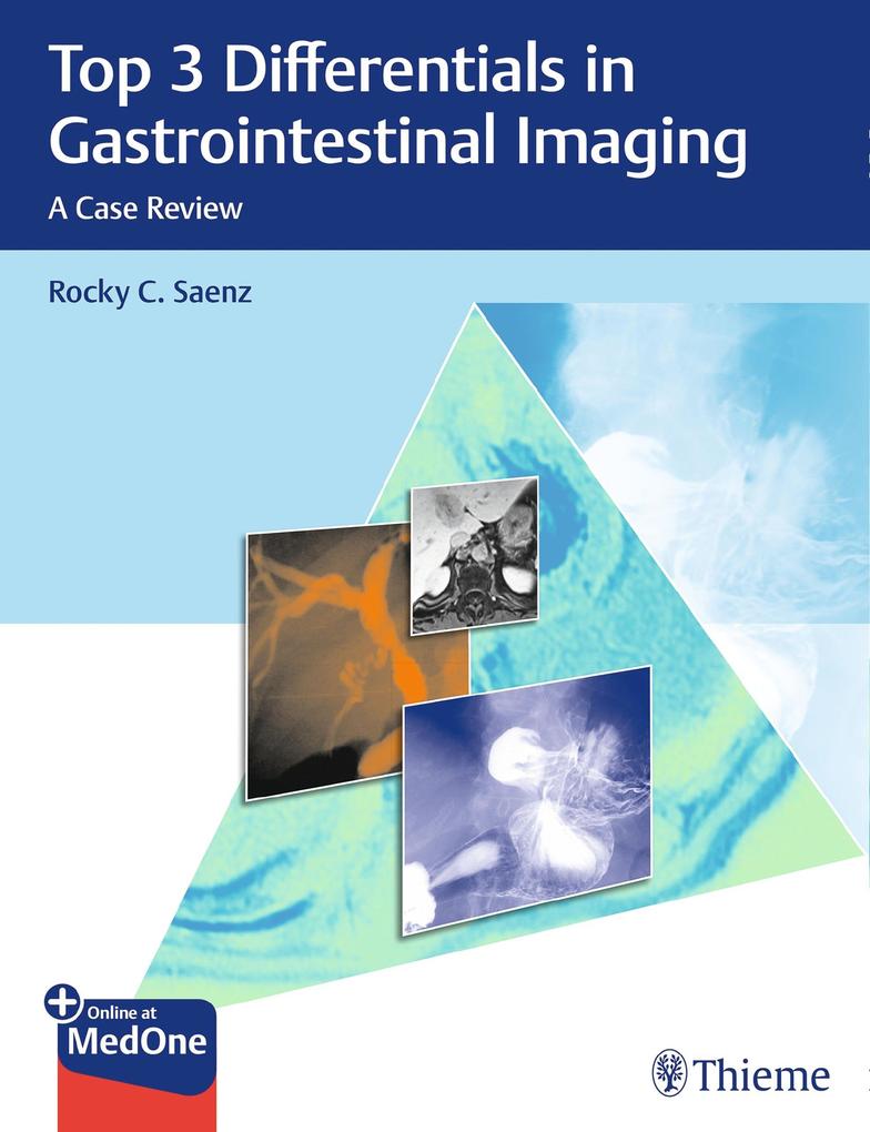 Produktbild: Top 3 Differentials in Gastrointestinal Imaging | Rocky C. Saenz