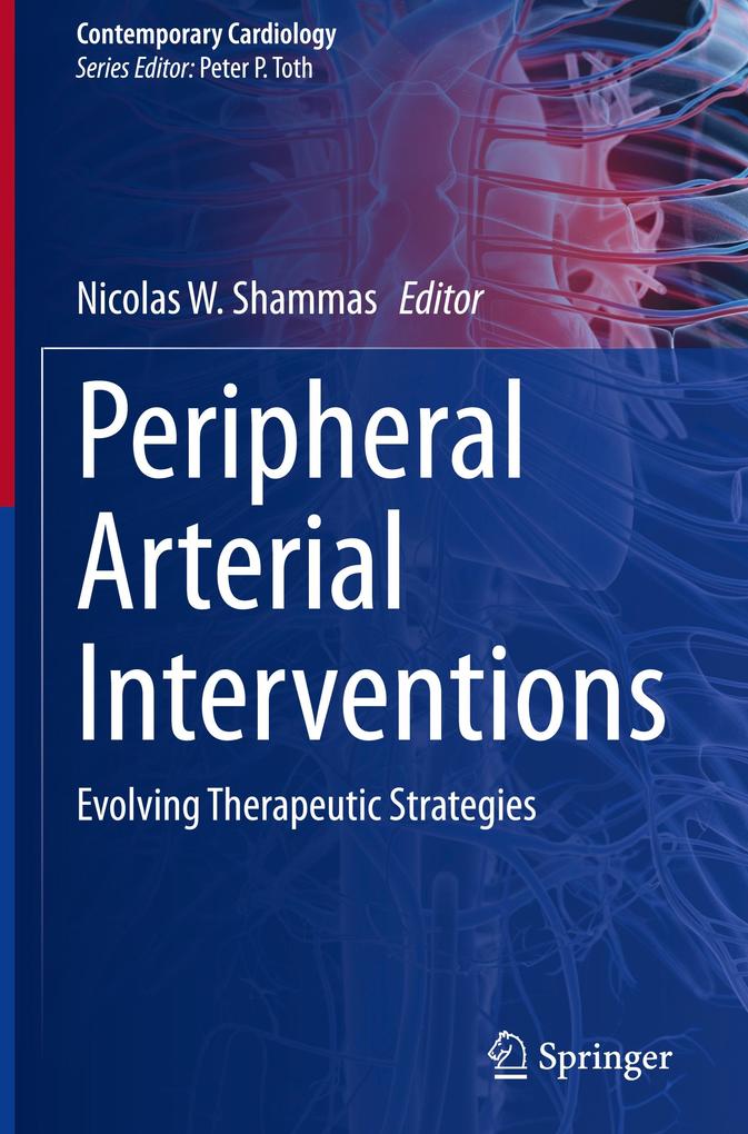 Produktbild: Peripheral Arterial Interventions