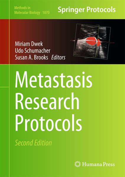Produktbild: Metastasis Research Protocols