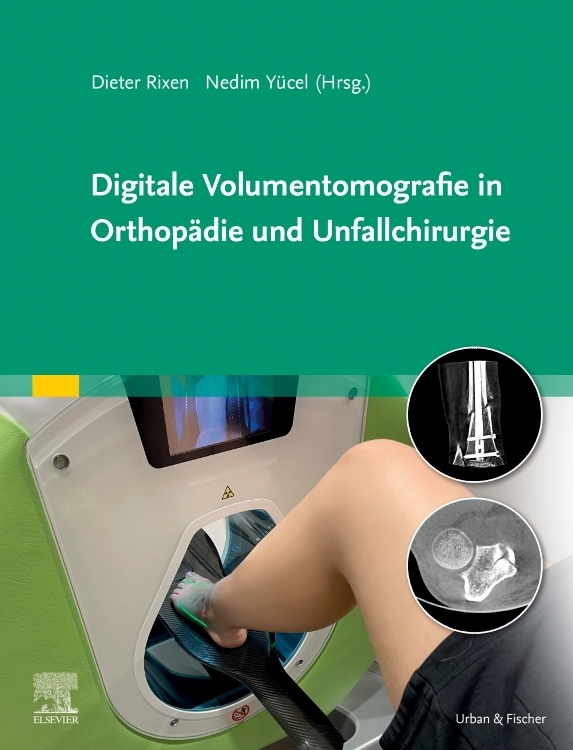 Produktbild: Digitale Volumentomografie in Orthopädie und Unfallchirurgie