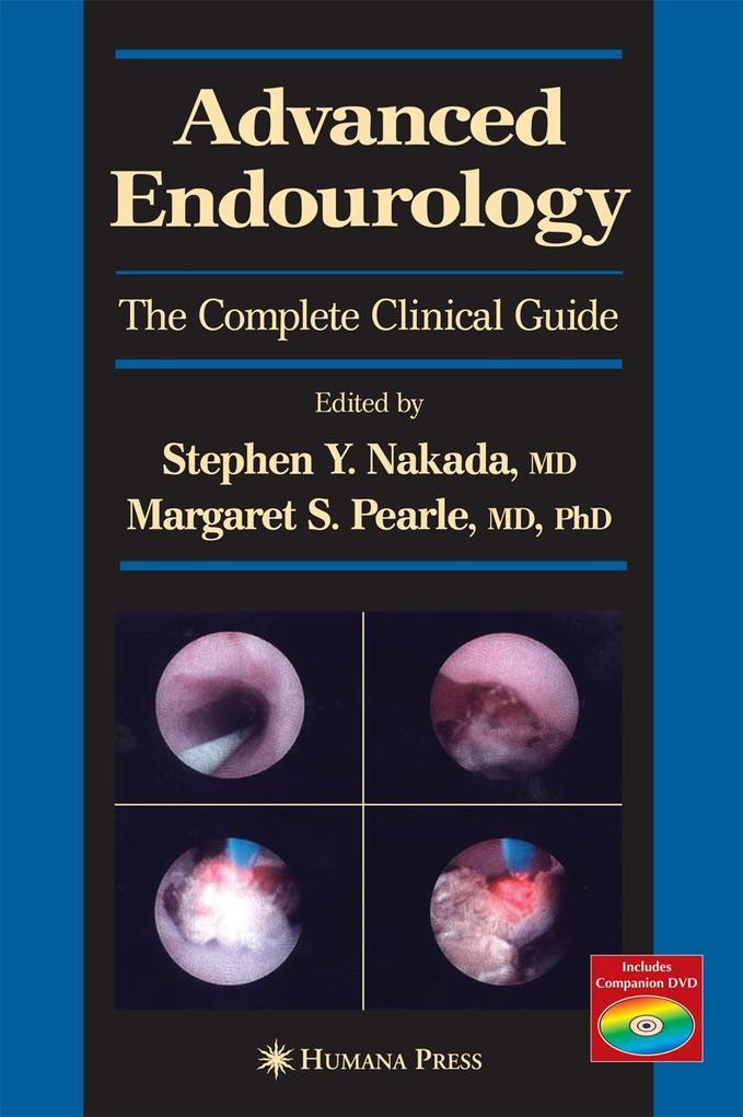Produktbild: Advanced Endourology | M. Nakada
