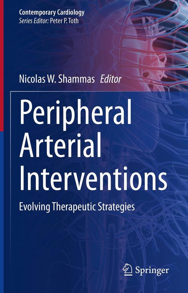 Produktbild: Peripheral Arterial Interventions