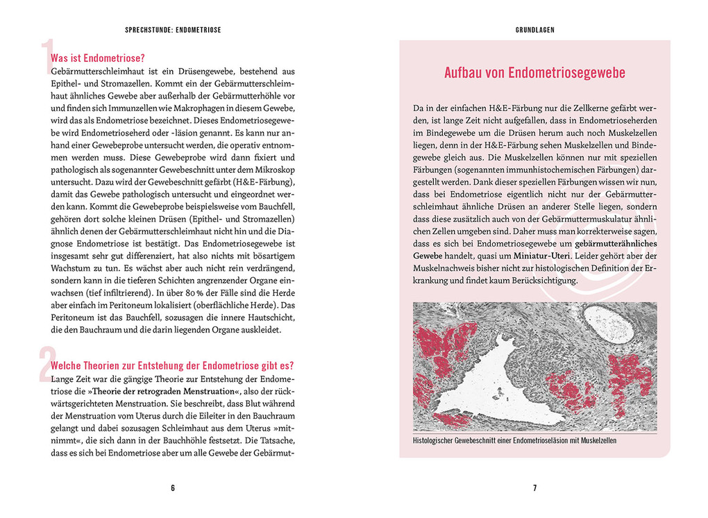 Weitere Ansicht: In der Sprechstunde: Endometriose; Erkennen - Verstehen -Behandeln | Sylvia Mechsner
