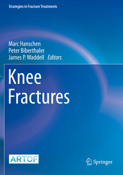 Produktbild: Knee Fractures