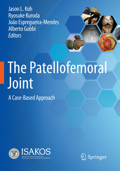 Produktbild: The Patellofemoral Joint