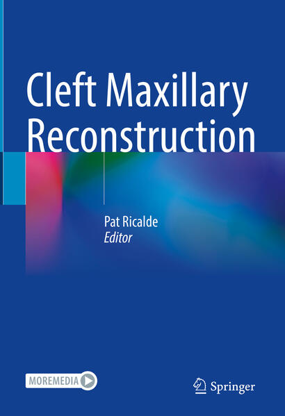 Produktbild: Cleft Maxillary Reconstruction