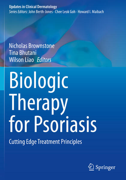 Produktbild: Biologic Therapy for Psoriasis