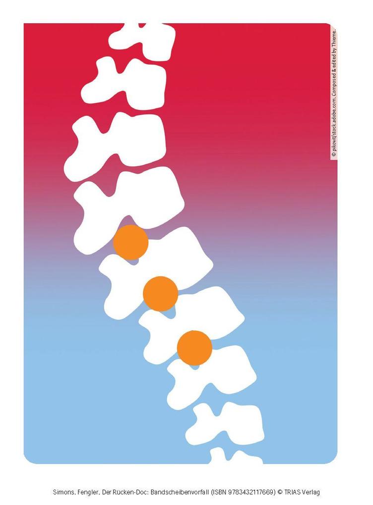 Weitere Ansicht: Der Rücken-Doc: Bandscheibenvorfall | Patrick Simons, Arndt Fengler