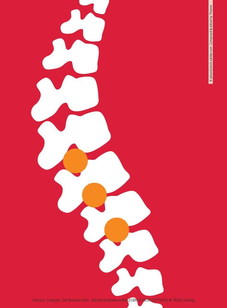 Weitere Ansicht: Der Rücken-Doc: Bandscheibenvorfall | Patrick Simons, Arndt Fengler