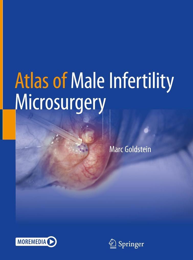 Produktbild: Atlas of Male Infertility Microsurgery | Marc Goldstein