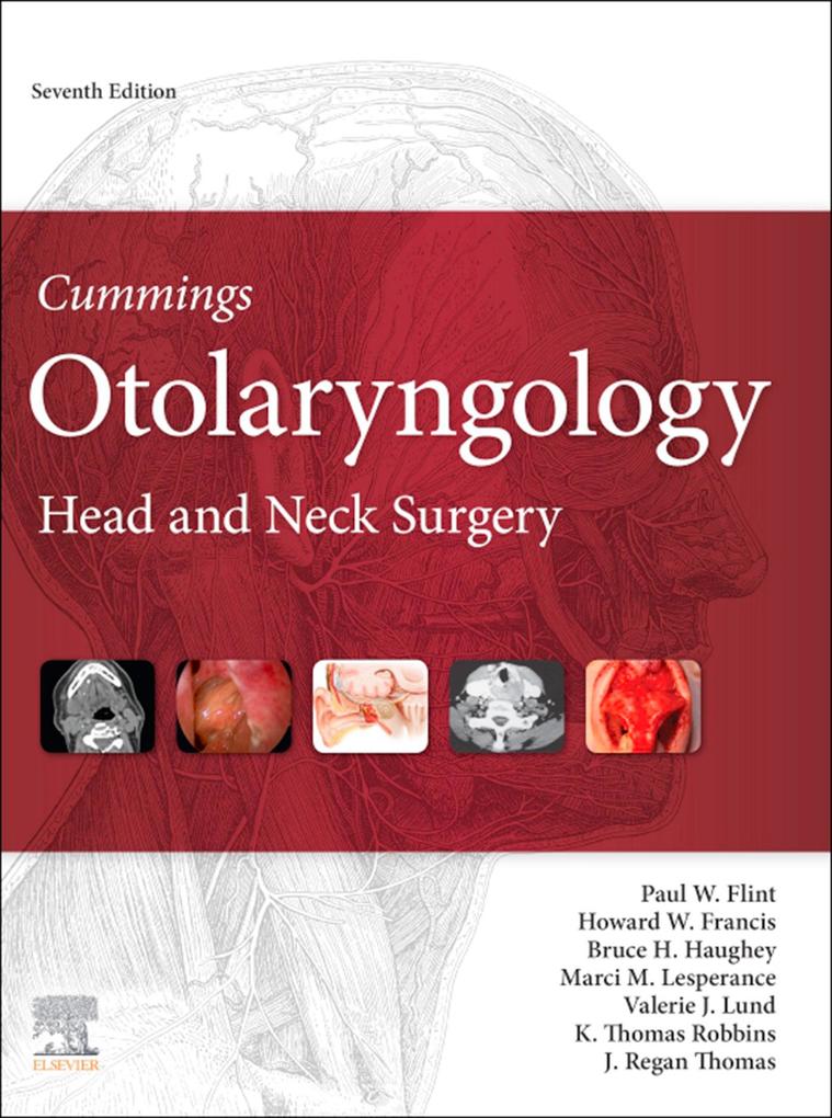 Produktbild: Cummings Otolaryngology E-Book | Marci M. Lesperance MD, Facs Thomas MD, Facs Robbins MD, Lund CBE, Facs Haughey MD
