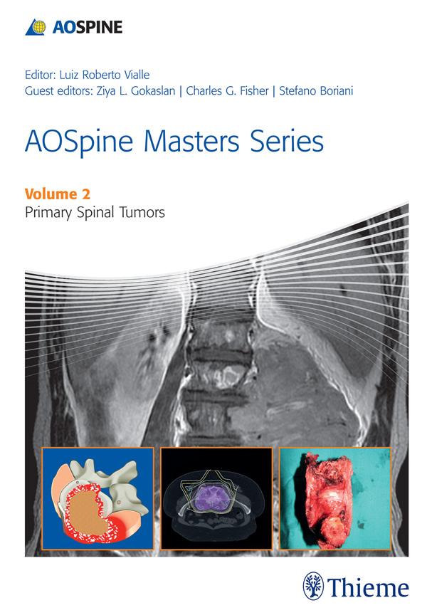 Produktbild: AOSpine Masters Series, Volume 2: Primary Spinal Tumors