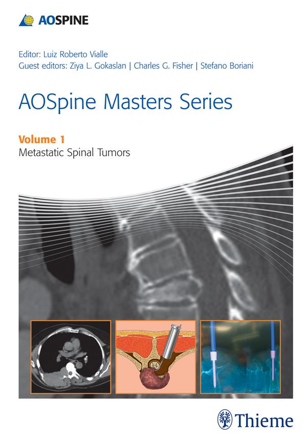Produktbild: AOSpine Masters Series, Volume 1: Metastatic Spinal Tumors