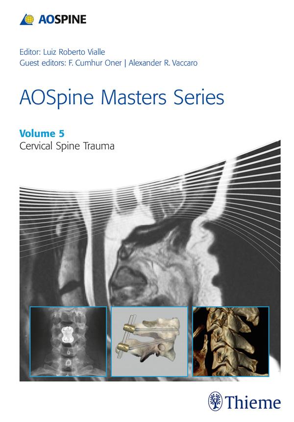 Produktbild: AOSpine Masters Series, Volume 5: Cervical Spine Trauma