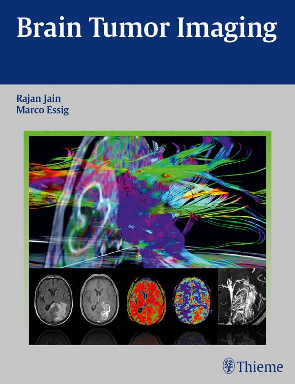 Produktbild: Brain Tumor Imaging | Rajan Jain, Marco Essig