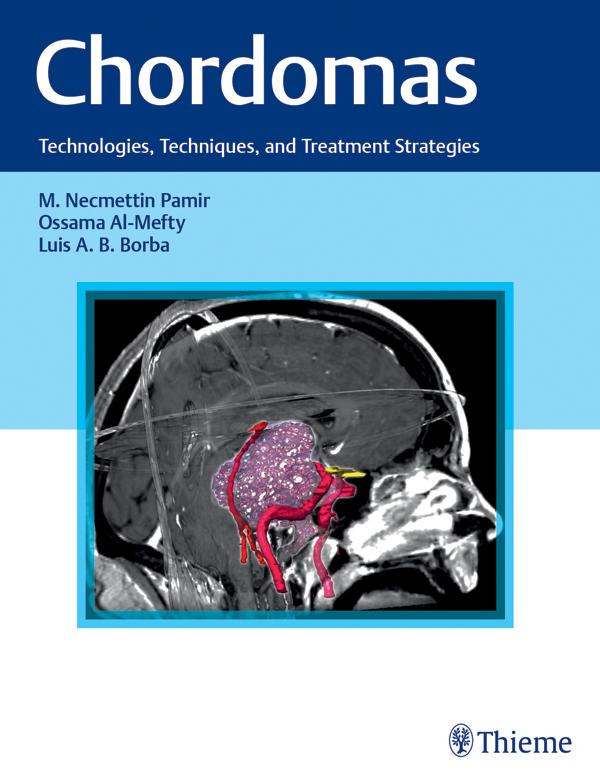 Produktbild: Chordomas