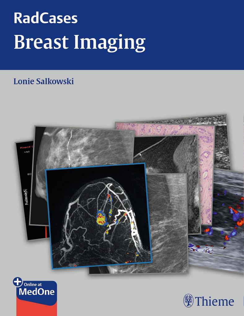 Produktbild: Radcases Breast Imaging | Lonie L. Salkowski