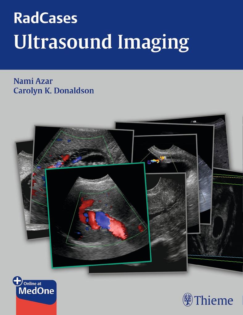 Produktbild: Radcases Ultrasound Imaging | Nami R. Azar, Carolyn Donaldson