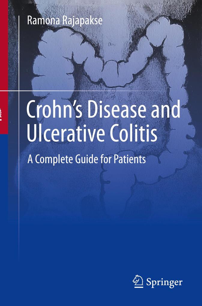 Produktbild: Crohn's Disease and Ulcerative Colitis | Ramona Rajapakse