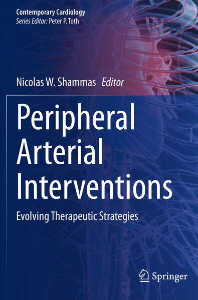 Produktbild: Peripheral Arterial Interventions