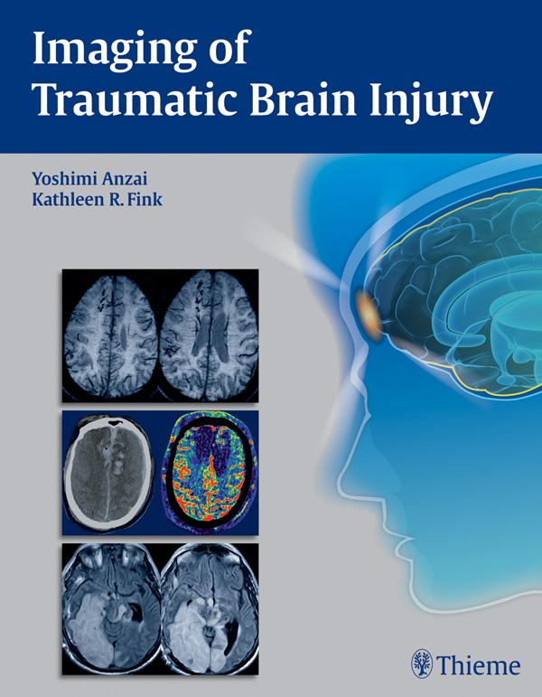 Produktbild: Imaging of Traumatic Brain Injury
